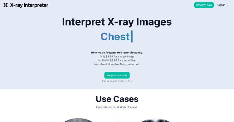 X-ray Interpreter featured image